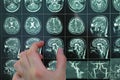 Doctors hand pointing to mri image Royalty Free Stock Photo