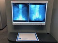 Kidneys X-ray On A Lght Box.