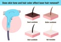 Does skin tone and hair color affect laser hair removal. Hair removal laser icon vector illustration. Flat vector hair