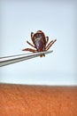 Dog Tick Removal Royalty Free Stock Photo