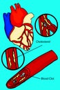 Doodle Heart - Blood Pressure Scheme