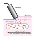 Doppler blood flow measurement Royalty Free Stock Photo