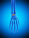 The dorsal radiocarpal ligaments Royalty Free Stock Photo