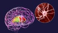 Dorsal striatum highlighted in human brain and close-up view of degrading neurons