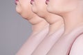 Double chin, skin rejuvenation on the neck, before after anti aging concept Royalty Free Stock Photo