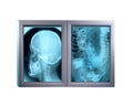 Double x-ray minitor,isolated Royalty Free Stock Photo