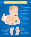 Down Syndrom Symptoms