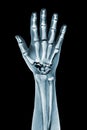 Dramatized x ray of a hand on black