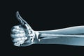 Dramatized x ray of a hand thumbs up Royalty Free Stock Photo