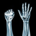 Dramatized x ray of two hands on black