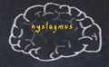 Drawind of human brain on chalkboard with inscription nystagmus