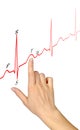 Drawing ECG Royalty Free Stock Photo