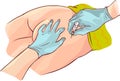 Drawing of Gloved hands aspirating syringe at dorsogluteal site of injection