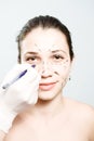 Drawing lines for facial plastic surgery Royalty Free Stock Photo