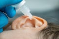 dripping ear drops into patient ear. ear pain and clogged ears concept