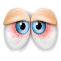 Droopy Tired Bloodshot Eyes Royalty Free Stock Photo