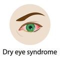 Dry eye syndrome. Vector illustration.