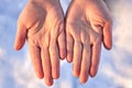 Dry female hands in winter on a background of snow