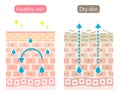 Dry and healthy skin cell layer before after illustration. moisture evaporation from the skin. Beauty and skin care concept