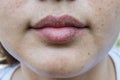Dry lips, Lack of skin lips maintenance Royalty Free Stock Photo