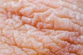 Dry skin or ichthyosis texture detail. Extreme close up macro shot dehydration skin. Royalty Free Stock Photo