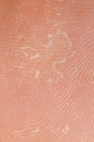 Dry skin texture Royalty Free Stock Photo