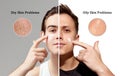 Dry skin vs oily ski problems. Young men with different skin types using cream for nutrition, moisturizing and healthy Royalty Free Stock Photo