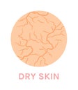 Dry Unhealthy Skin. Close-up. Facial and Body Skin Problems. Color Cartoon style. Circle. Zoom. White background. Vector Royalty Free Stock Photo