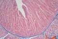 Duodenum biopsy from the pathology of  small intestine Royalty Free Stock Photo