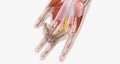 Dupuytrens contracture is a condition in which fibrotic tissue and collagen accumulate in the palmar aponeurosis