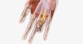 Dupuytrens contracture is a condition in which fibrotic tissue and collagen accumulate in the palmar aponeurosis