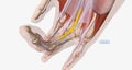 Dupuytrens contracture is a condition in which fibrotic tissue and collagen accumulate in the palmar aponeurosis