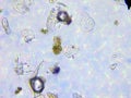 Dust and microorganisms microscopic view Royalty Free Stock Photo