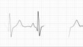 Dynamic heart rate or heart beat line. Cardiogram signal.