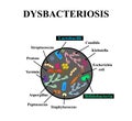 Dysbacteriosis of the intestine. Lactobacillus, Bifidobacteria, Streptococcus, Staphylococcus, E. coli, Aspergyllus mushrooms