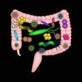 Dysbacteriosis of the intestine. The large intestine. dysbiosis of colon. Bacteria, fungi, viruses. Infographics.
