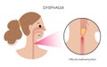 Dysphagia medical poster