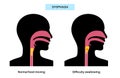 Dysphagia medical poster Royalty Free Stock Photo