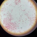 E.coli Bacteria Under a Compound Microscope