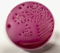 E.coli bacteria on VRB agar