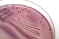 E. coli on MacConkey agar Royalty Free Stock Photo