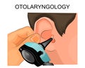 The ear examination using the Otoscope. otolaryngology Royalty Free Stock Photo