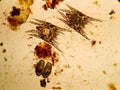 Ear mite from a cat, under the microscope