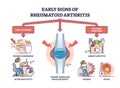 Early signs of rheumatoid arthritis disease and joint pain outline diagram