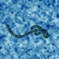 Ebola virus.