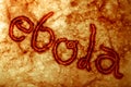 Ebola Virus