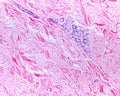 Eccrine sweat gland