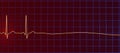 ECG in asystole, 3D illustration