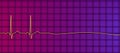 ECG in asystole, 3D illustration