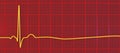 ECG in asystole, 3D illustration